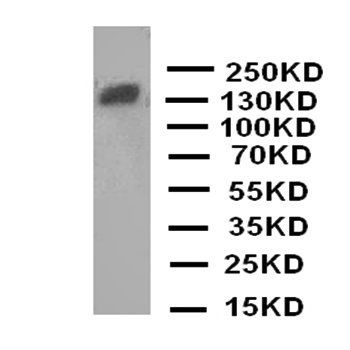 Zinc finger protein GLI2 Gli2 Antibody