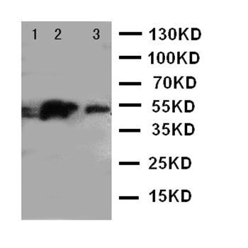 IRAK4 Antibody