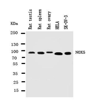 Anti-NADPH oxidase 5 NOX5 Antibody