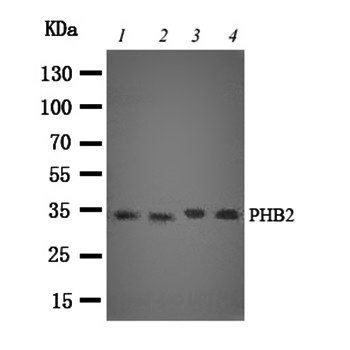 Anti-REA/PHB2 Antibody