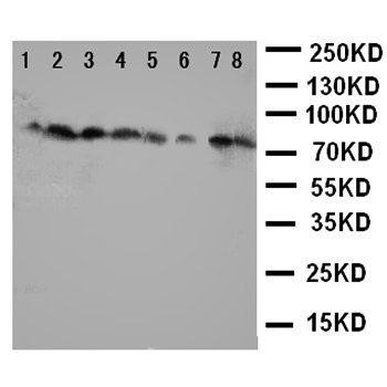 Cytochrome P450 Reductase/POR Antibody