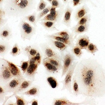Anti-DDX4/MVH Antibody