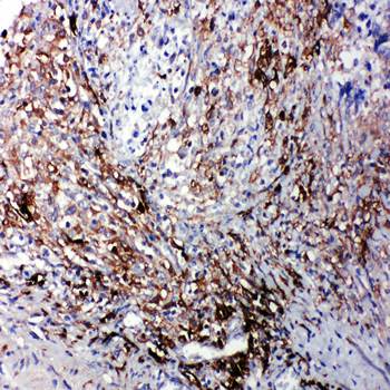 LTBR Antibody