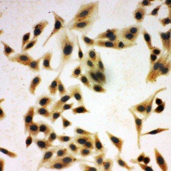 Anti-NRG1 Antibody