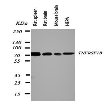 Anti-TNF Receptor II/TNFRSF1B Antibody