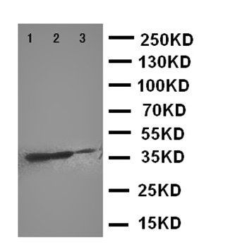 DR4/TNFRSF10A Antibody