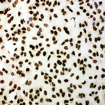 Anti-53BP1/TP53BP1 Antibody