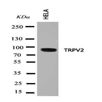 Anti-VRL1/TRPV2 Antibody
