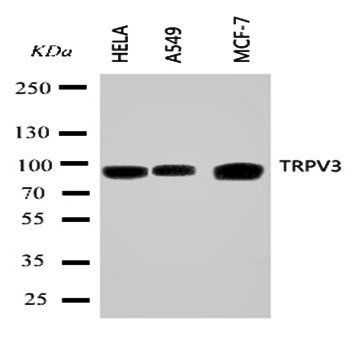 TRPV3 Antibody