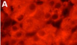 hMSRB2 Antibody