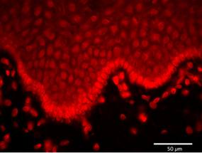 hMSRA antibody