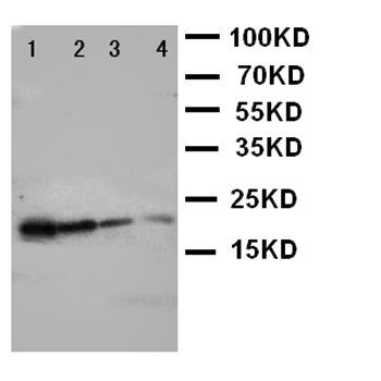 Anti-Growth Hormone/GH1 Antibody