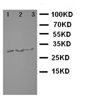 Anti-survivin/BIRC5 Antibody