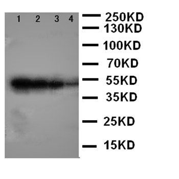 BMPR1B Antibody
