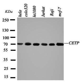 Anti-CETP Antibody