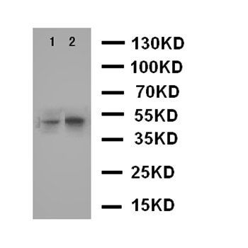 Anti-CXCR5 Antibody