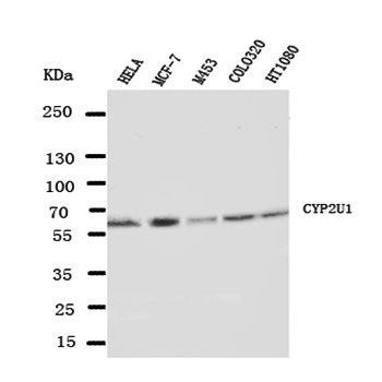 Cytochrome P450 2U1 CYP2U1 Antibody