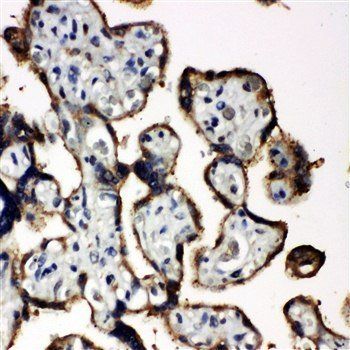 Anti-EIF2S1 Antibody