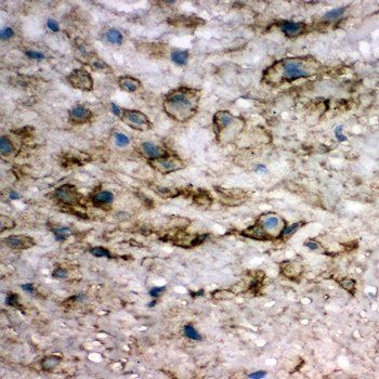 Anti-integrin beta 4 binding protein/EIF6 Antibody