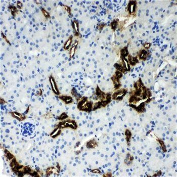 Anti-Kallikrein 1/KLK1 Antibody
