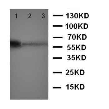 Anti-MBD4 Antibody