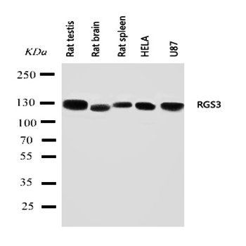 Anti-RGS3 Antibody