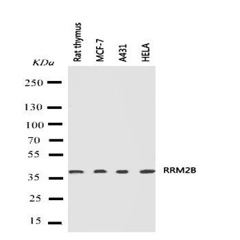 p53R2/RRM2B Antibody