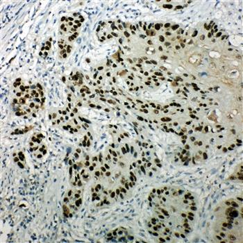 p63/TP63 Antibody