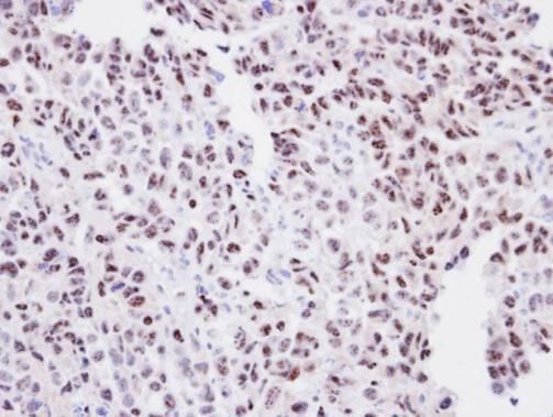 ORC2 Rabbit Polyclonal Antibody