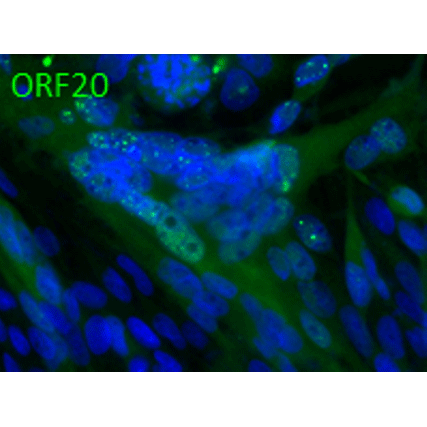 Anti-ORF20 (VZV) antibody