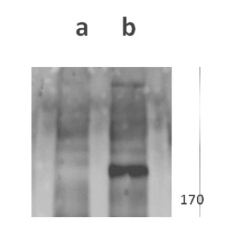 Anti-ORF22 (VZV) antibody