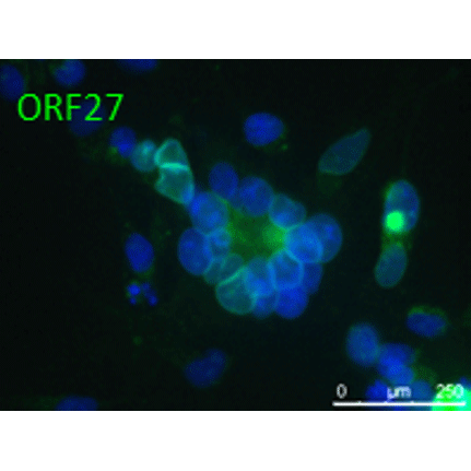 Anti-ORF27 (VZV) antibody