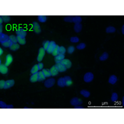 Anti-ORF32 (VZV) antibody