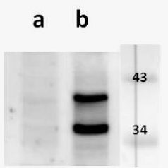 Anti-ORF33,5 (VZV) antibody
