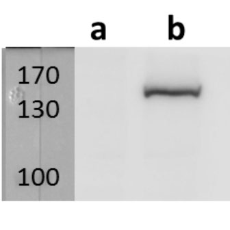 Anti-ORF40/MCP (VZV) antibody