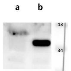 Anti-ORF41 (VZV) antibody