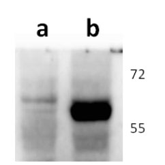 Anti-ORF47 (VZV) antibody