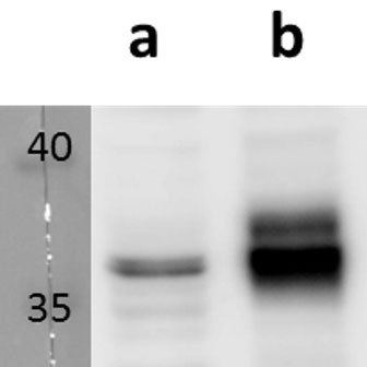 Anti-ORF53 (VZV) antibody