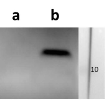 Anti-ORF57 (VZV) antibody