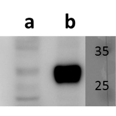 Anti-ORF58 (VZV) antibody