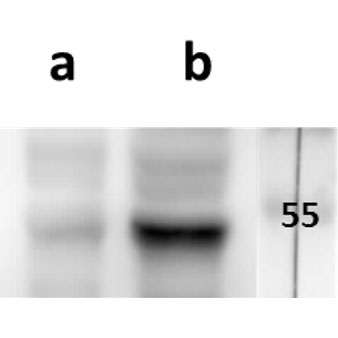 Anti-ORF5 (VZV) antibody