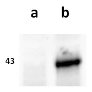 Anti-ORF63 (VZV) antibody