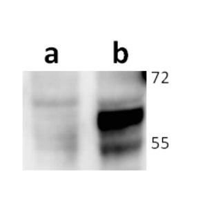 Anti-ORF67 (VZV) antibody