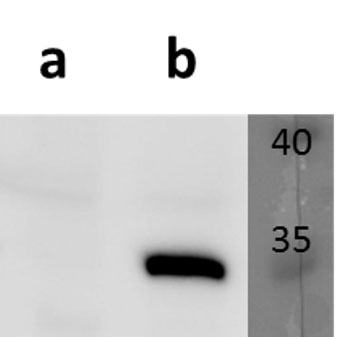 ORF7 (VZV) antibody