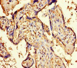 Origin recognition complex subunit 4 antibody