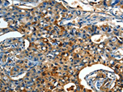 ORM1 Antibody