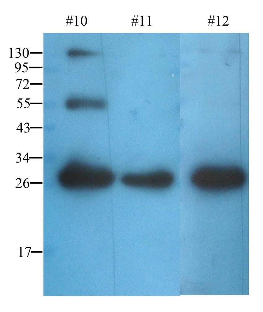 ORM1 antibody