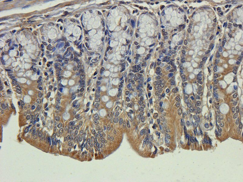 ORM1 antibody