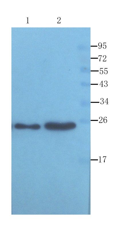 ORM1 antibody