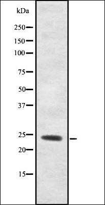 ORM2 antibody